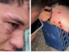 Herido menor de edad tras una tángana en vacacional de fútbol en Barinas