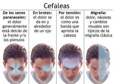 Tipos-cefaleas.jpg